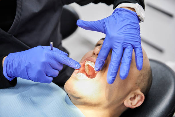 Best Emergency Wisdom Tooth Extraction in Underwood, IA