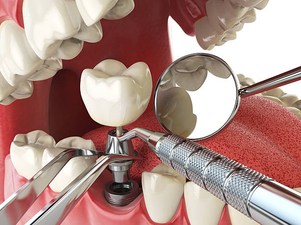 Best Emergency Treatment for Jaw Pain or Injury in Underwood, IA